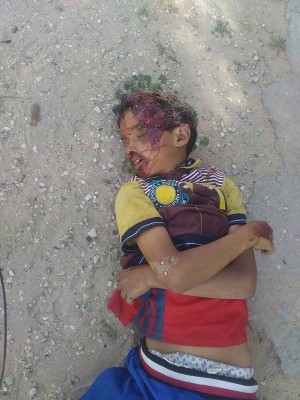 الطفل يوسف أحمد هليل الذي قتل بقذائف جيش الانقلاب في حي الترابين بالشيخ زويد