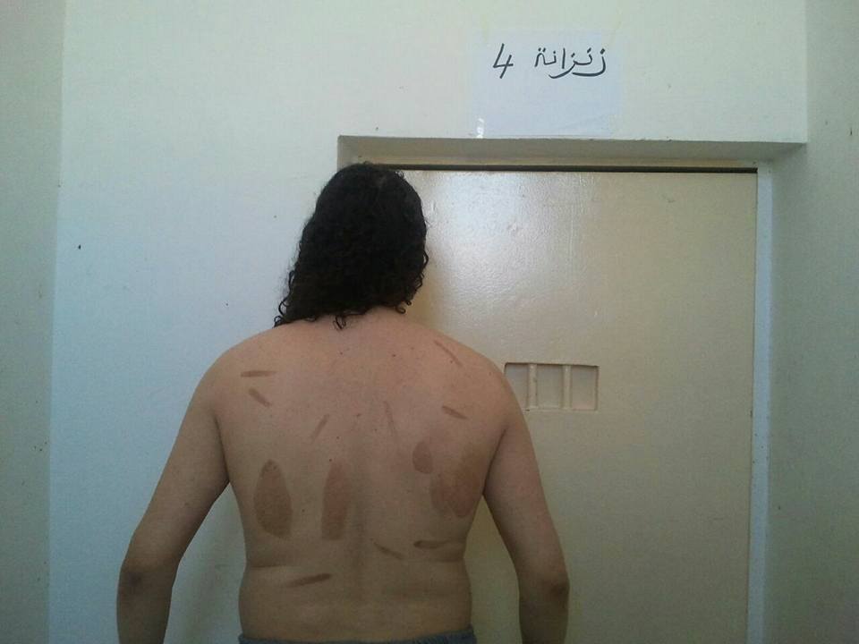 التعذيب في المغرب - محمد حاجب نموذجاً