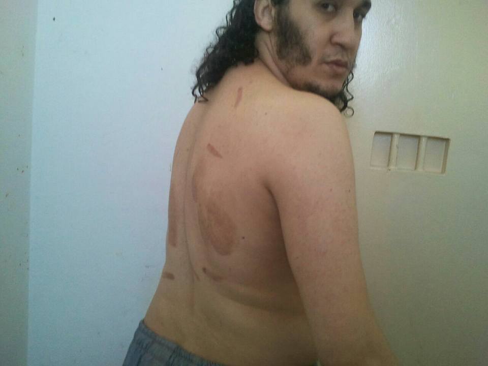 التعذيب في المغرب - محمد حاجب نموذجاً